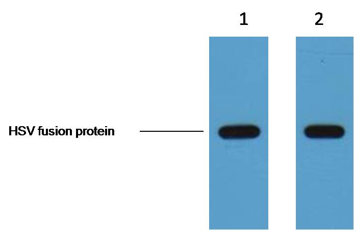 1ug HSV fusion protein+ Primary antibody dilution at 1. 1:5,000 2. 1:10,000