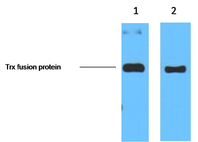 1ug Trx fusion protein+ Primary antibody dilution at 1. 1:5,000 2. 1:10,000