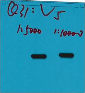 Western blot analysis of V5 recombinant protein with V5 Mouse mAb(Q31) diluted at 1) 1:5,000 2) 1:10,000