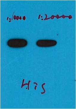 Western blot analysis of His recombinant protein with His Mouse mAb(4E6) HRP Conjugated diluted at 1) 1:10,000 2) 1:20,000