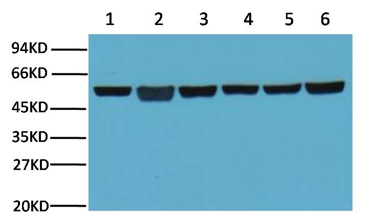 Western blot analysis of A549 (1) , Rat brain (2) ,Mouse brain (3) ,Chicken lung (4) and Rabbit testis (5),Sheep muscle (6) with Beta-tubulin mouse mAb(5G3) diluted at 1:5000.