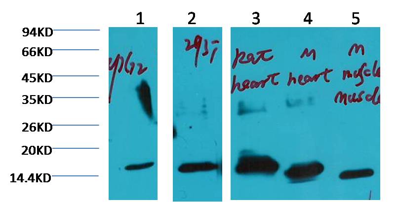 Western blot analysis of 1) HepG2, 2) 293T, 3) Rat Heart, 4) Mouse Heart, 5) Mouse Muscle tissue with COX IV Mouse mAb) diluted at 1:3,000.
