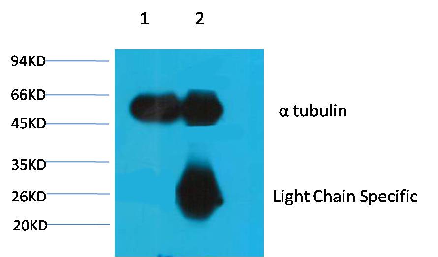 1. Input: Mouse Brain Tissue Lysate 2. IP product: IP dilute 1:200 Western blot analysis: primary antibody : EM1034 1:5,000 Secondary antibody: Goat anti-Mouse IgG, Light chain specific (S003), 1:5,000