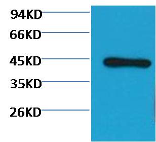 Western blot analysis of Hela with EM1038 diluted at 1:3,000.