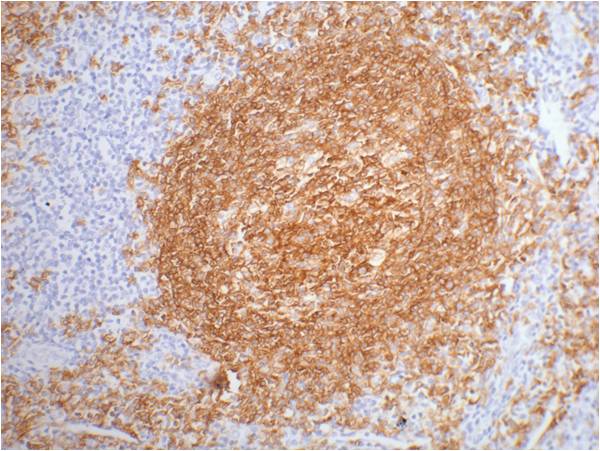 IHC staining of Human tonsil tissue paraffin-embedded with CD20 mouse mAb (2F4) diluted at 1:200.