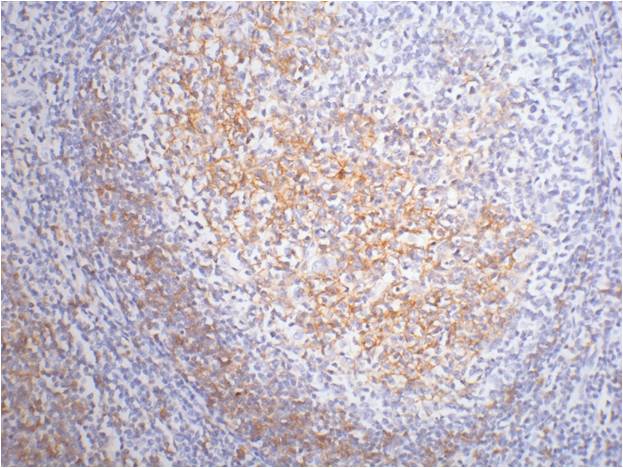 IHC staining of Human tonsil tissue paraffin-embedded with CD23 mouse mAb (1E9) diluted at 1:200.