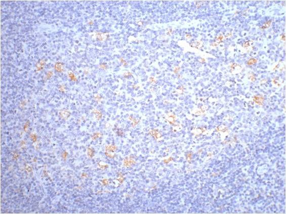 IHC staining of human tonsil tissue with CD68 mouse mAb(6F3) diluted at 1:200.