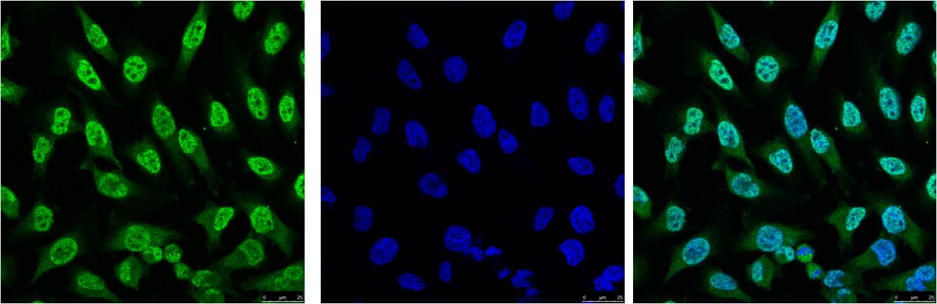 IF analysis of Hela with EM1052(Left) and DAPI (Right) diluted at 1:100.