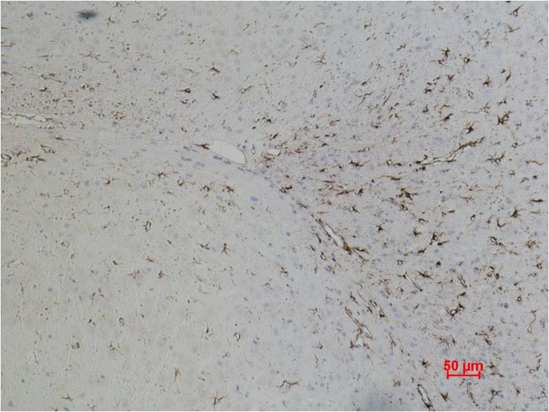 Immunohistochemical analysis of paraffin-embedded Rat Brain Tissue using GFAP (EM1059) Mouse mAb diluted at 1:500.