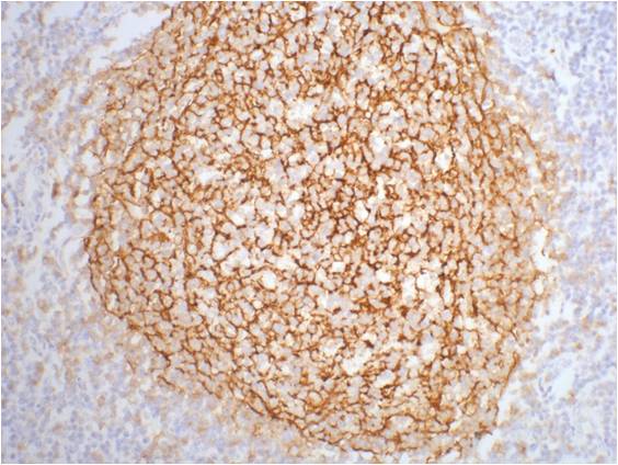 IHC staining of human tonsil tissue with CD21 mouse mAb(2C5) diluted at 1:200.