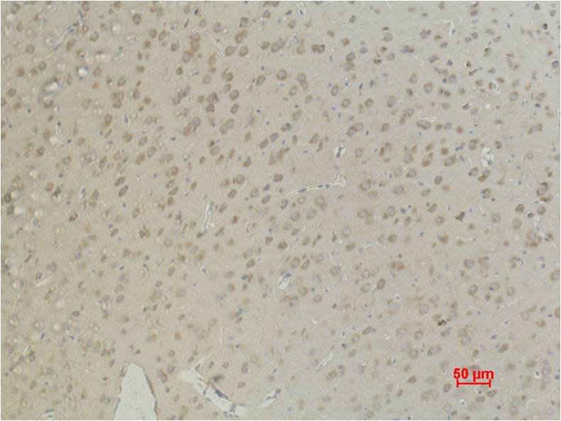 Immunohistochemical analysis of paraffin-embedded Rat Brain Tissue using Aquaporin 4 (EM1062) Mouse mAb diluted at 1:500.