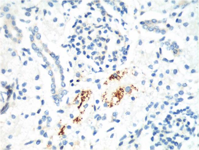IHC staining of Mouse Kidney tissue with Kif 7 mouse mAb(3F8) diluted at 1:200.