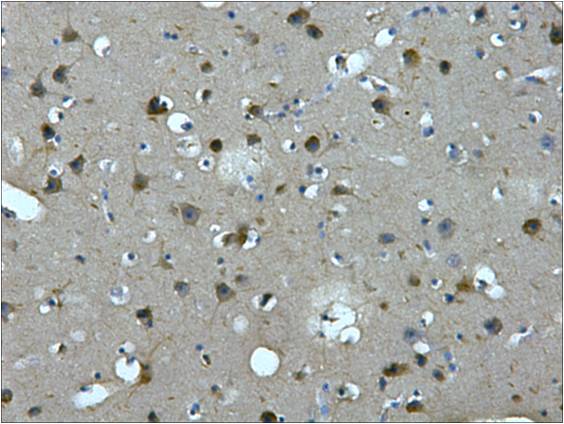 IHC staining of Human brain tissue paraffin-embedded with MAP2 mouse mAb (7D4) diluted at 1:200.