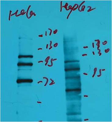 Western blot analysis of Hela, HepG2,with IDE Mouse mAb diluted at 1:2,000.