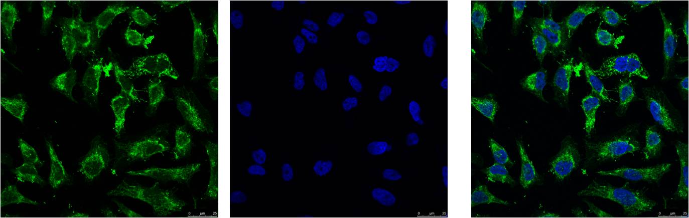 IF analysis of Hela with EM1085(Left) and DAPI (Right) diluted at 1:100