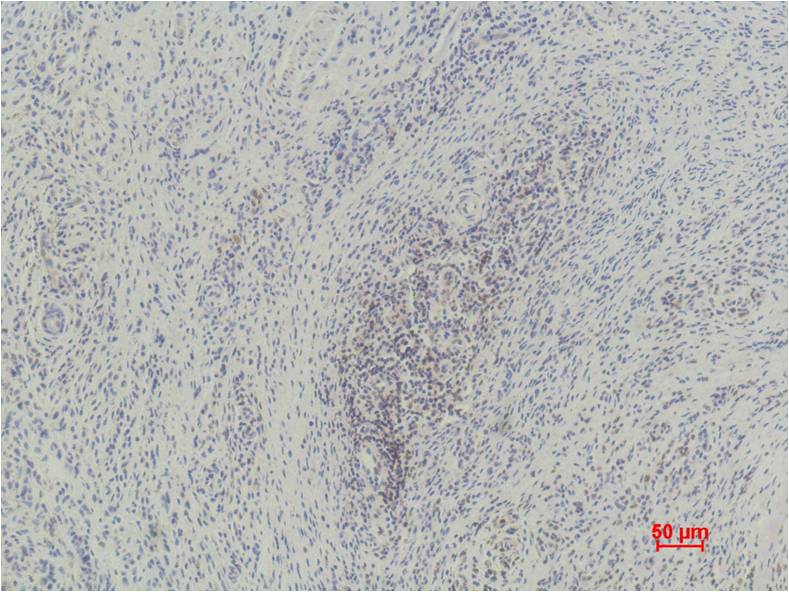 Immunohistochemical analysis of paraffin-embedded Human Skin using Histone H3(momo methyl K79) (EM1099) Mouse mAb diluted at 1:500.