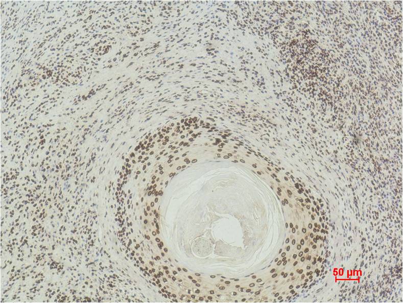 Immunohistochemical analysis of paraffin-embedded Human Skin using Histone H3(di methyl K27) (EM1101) Mouse mAb diluted at 1:500.
