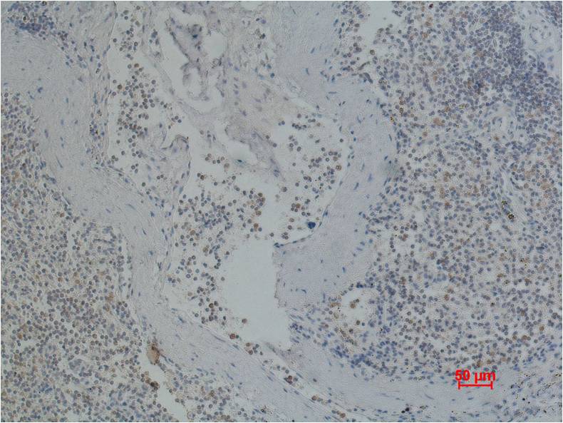 Immunohistochemical analysis of paraffin-embedded Human Spleen using CD41 (EM1106) Mouse mAb diluted at 1:200.
