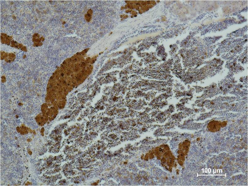 Immunohistochemical analysis of paraffin-embedded Mouse SpleenTissue using CD 25 (EM1107) Mouse mAbdiluted at 1:500.