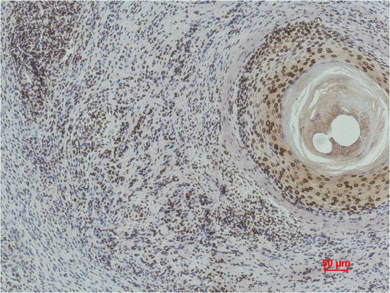 Immunohistochemical analysis of paraffin-embedded Human Skin using Histone H3(di methyl K9) (EM1108) Mouse mAb diluted at 1:500.