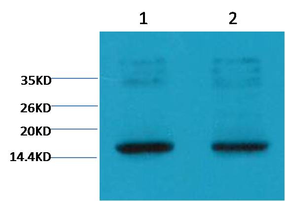 Western blot analysis of Hela with EM1109 diluted at 1) 1:2,000 2) 1:5,000