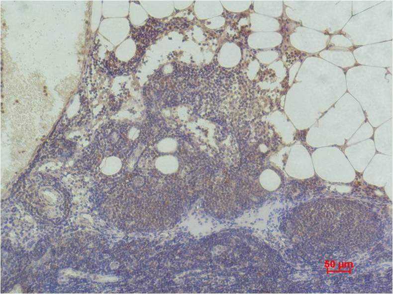 Immunohistochemical analysis of paraffin-embedded Human Clolon using Histone H3(tri methyl K9) (EM1109) Mouse mAb diluted at 1:500.