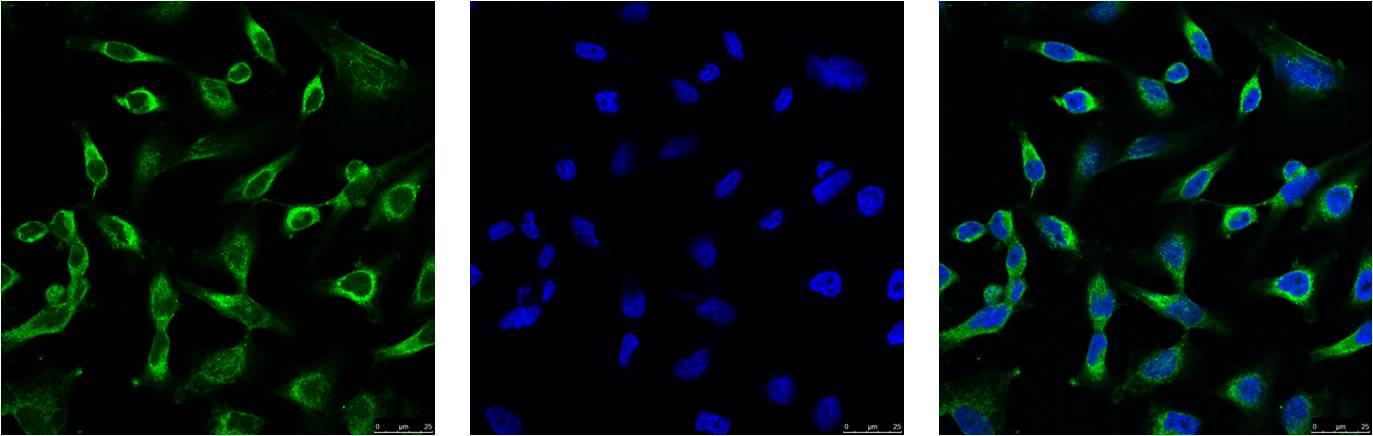 IF analysis of Hela with EM1112(Left) and DAPI (Right) diluted at 1:100.