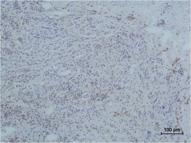 Immunohistochemical analysis of paraffin-embedded human Skin Tissue using Collagen III (EM1123) Mouse mAb diluted at 1:500.