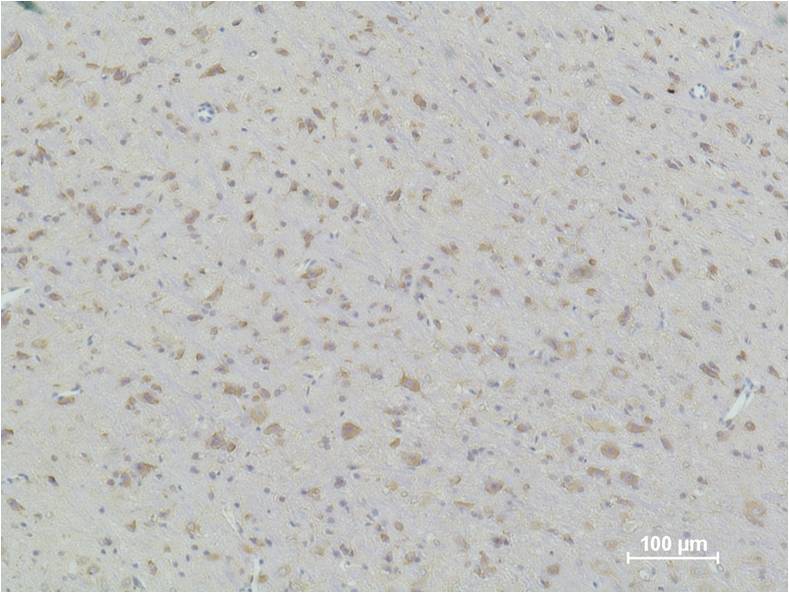 Immunohistochemical analysis of paraffin-embedded Rat Brain Tissue using HSP90b (EM1130) Mouse mAbdiluted at 1:500.