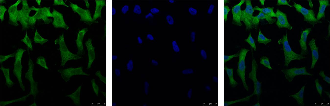 IF analysis of Hela with EM1136(Left) and DAPI (Right) diluted at 1:100.