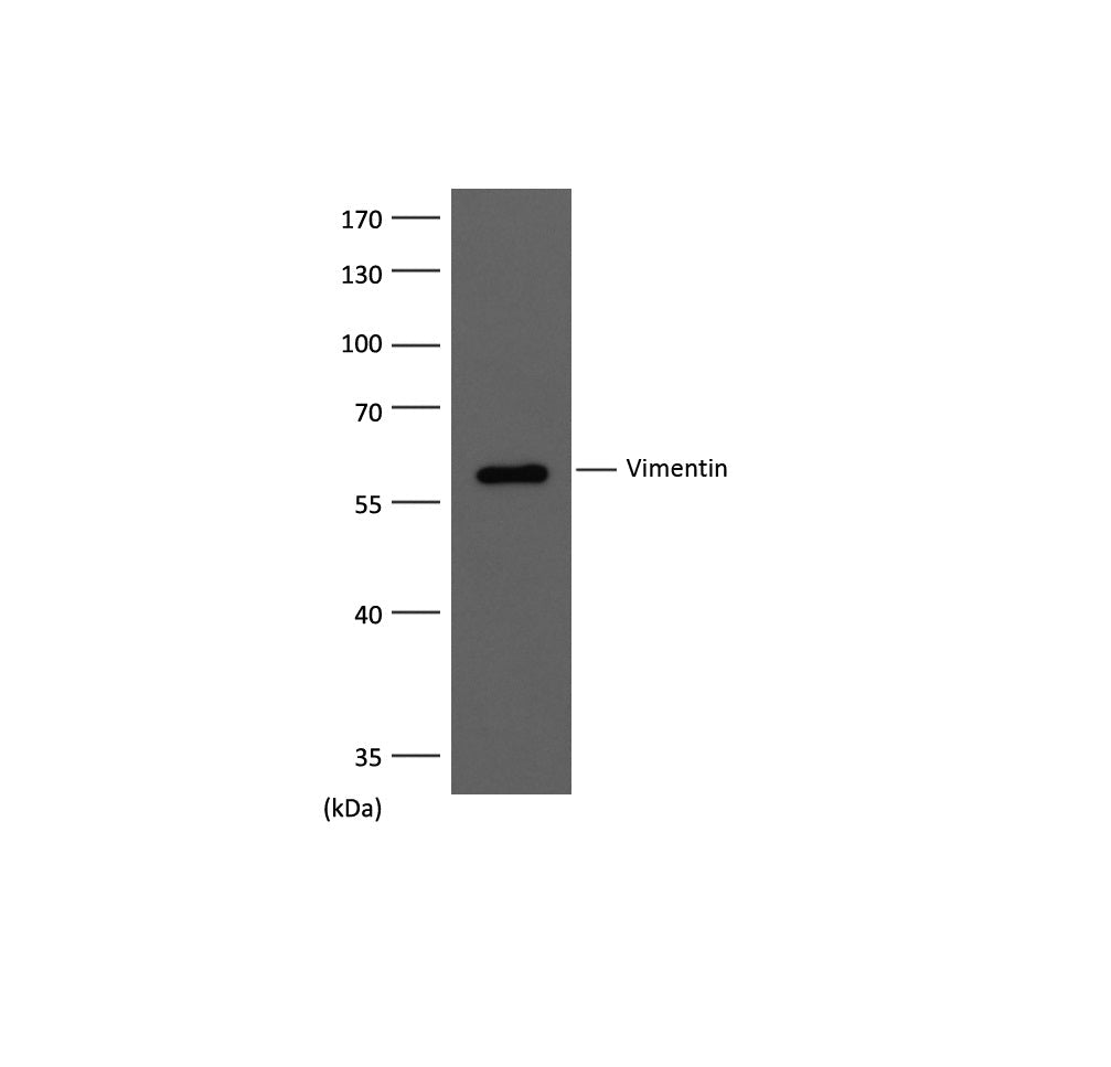 Western blot analysis of extracts from MCF-7 using Vimentin diluted at 1:3,000