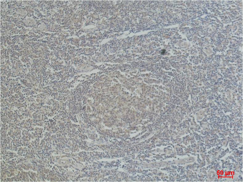 Immunohistochemical analysis of paraffin-embedded Human Tonsil Tissue using CD68 (EM1162) Mouse mAb diluted at 1:500.