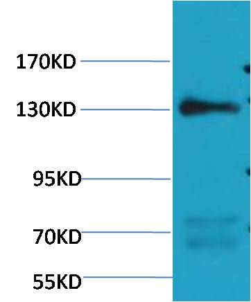 Western blot analysis of Rat Heart Tissue with eNOS (Mix-mA ™) Mouse mAb EM1165 diluted at 1:1,000.
