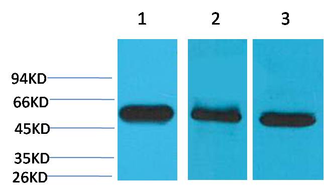 Western blot analysis of 1) Hela, 2)Mouse Brain Tissue, 3)Rat Brain Tissue with Caspase 8 Mouse mAb EM1179 diluted at 1:2,000.