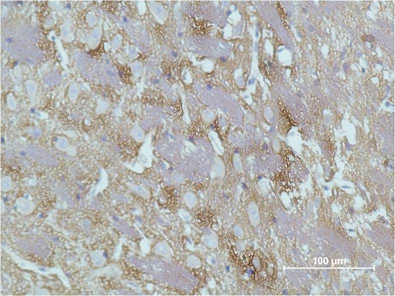 Immunohistochemical analysis of paraffin-embedded Rat Brain Tissue using GAP43 (EM1181) Mouse mAb diluted at 1:500.