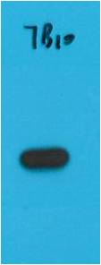 Western blot analysis of Recombinant S1-Tag Protein with S1-Tag Mouse mAb EM1195 diluted at 1:5,000.