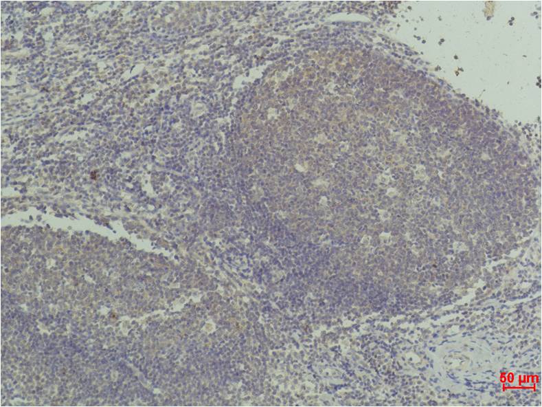 Immunohistochemical analysis of paraffin-embedded Human Tonsil Tissue using TNF a(EM1197) Mouse mAb diluted at 1:50.