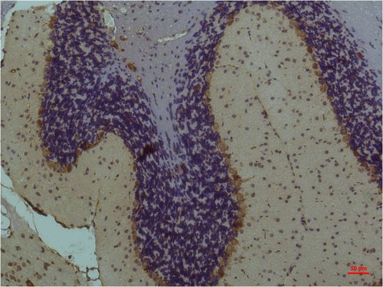 Immunohistochemical analysis of paraffin-embedded Mouse Brain Tissue using STAT3 (EM1207) Mouse mAb diluted at 1:200.