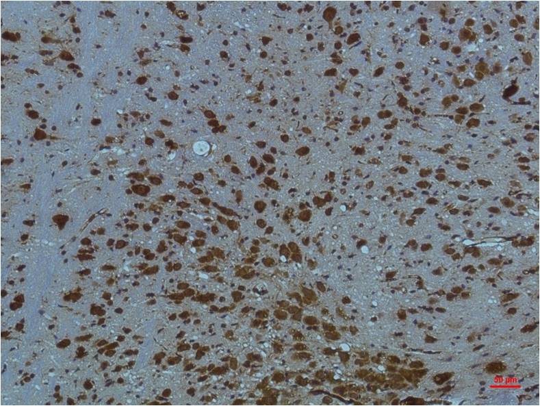 Immunohistochemical analysis of paraffin-embedded Mouse BrainTissue using PI3 Kinase P85 Alpha (EM1209) Mouse mAb diluted at 1:200.