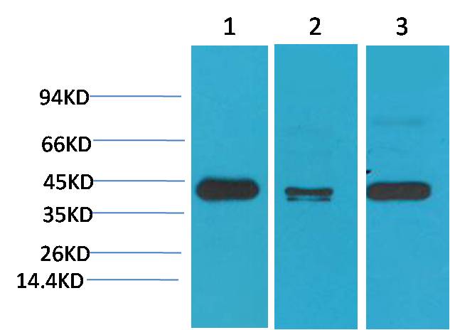 Western blot analysis of 1) Hela, 2)Mouse Brain Tissue, 3) Rat Brain Tissue with TBP/TATA Binding Protein Mouse mAb EM1216 diluted at 1:2,000.