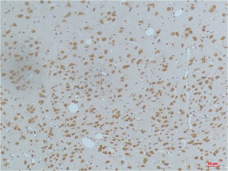 Immunohistochemical analysis of paraffin-embedded Rat Brain Tissue using CaMKIIBeta/ Gamma /δ (Phospho Thr287) (EM1222)Mouse mAb diluted at 1:200.