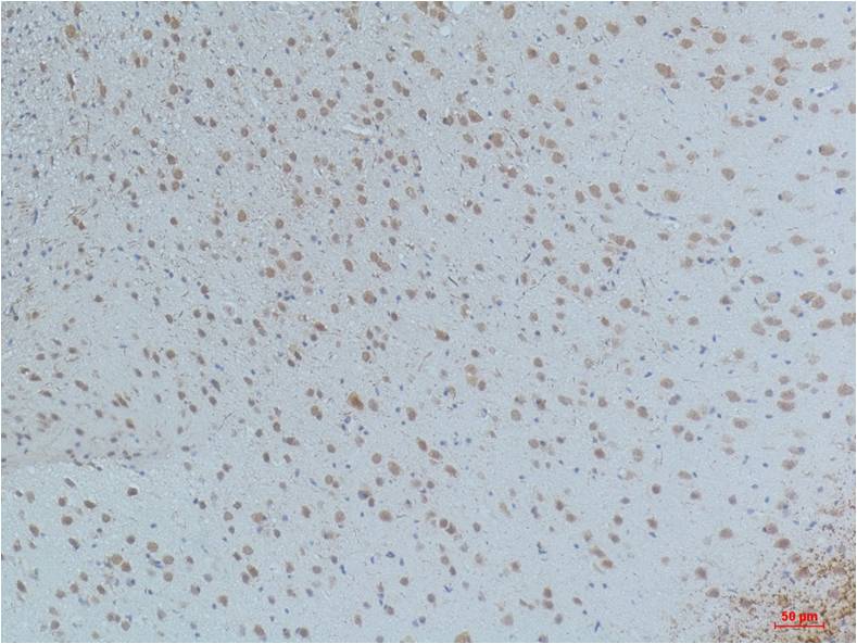 Immunohistochemical analysis of paraffin-embedded Mouse Brain Tissue using CaMKIIBeta/ Gamma /δ (Phospho Thr287) (EM1222)Mouse mAb diluted at 1:200.