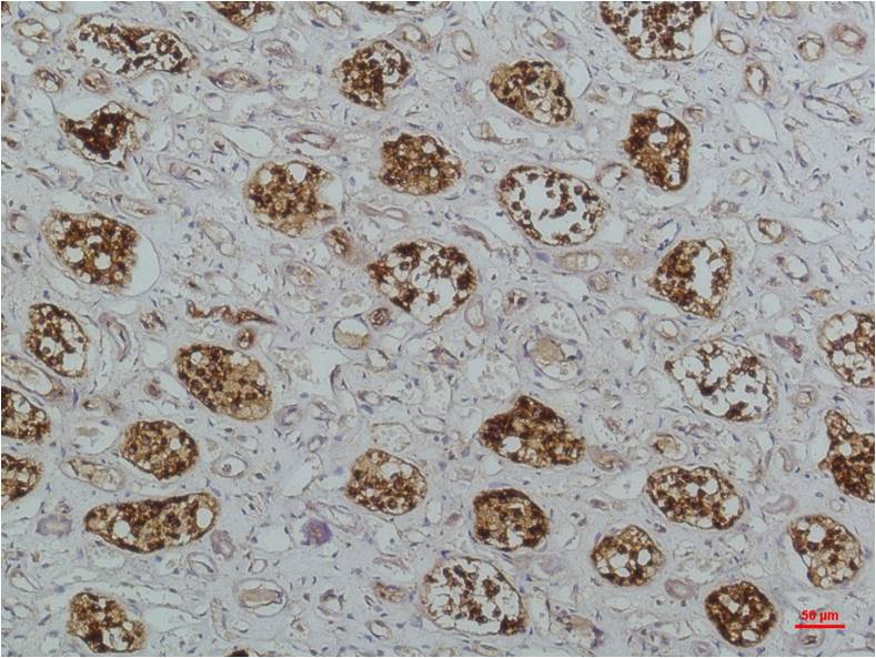 Immunohistochemical analysis of paraffin-embedded Human Kidney Tissue using IκB Beta(EM1226)Mouse mAb diluted at 1:200.