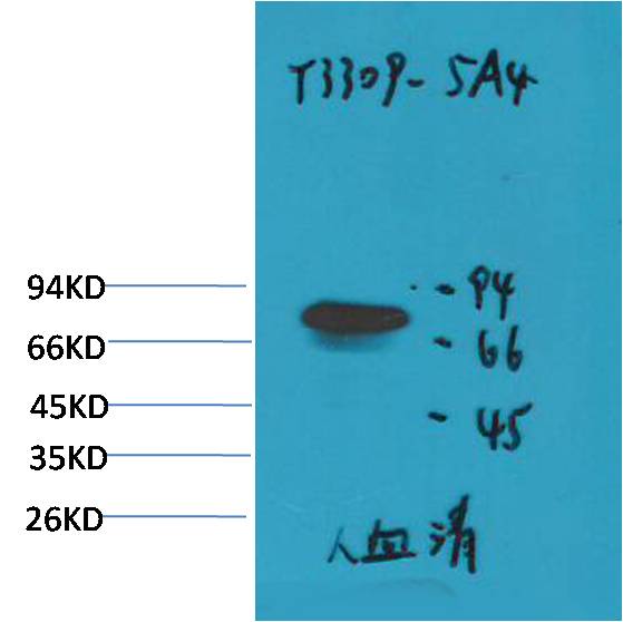 Western blot analysis of Human Serum with Transferrin Mouse mAb EM1231 diluted at 1:2,000.