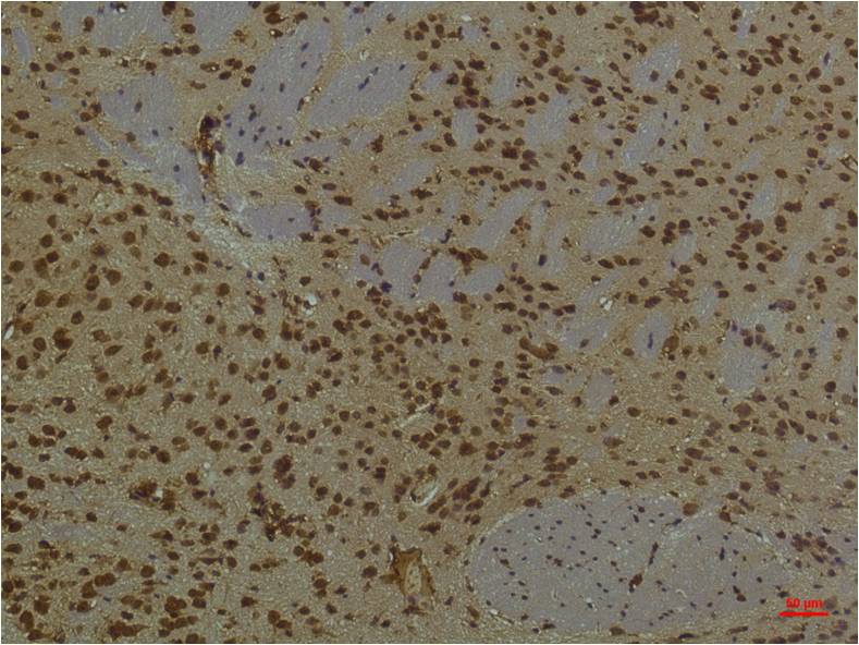 Immunohistochemical analysis of paraffin-embedded Mouse BrainTissue using HIF-1 Beta/ARNT (EM1242) Mouse mAb diluted at 1:200.