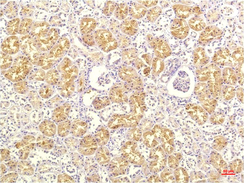 Immunohistochemical analysis of paraffin-embedded Human Kidney Tissue using IL-8 (EM1260) Mouse mAb diluted at 1:200.