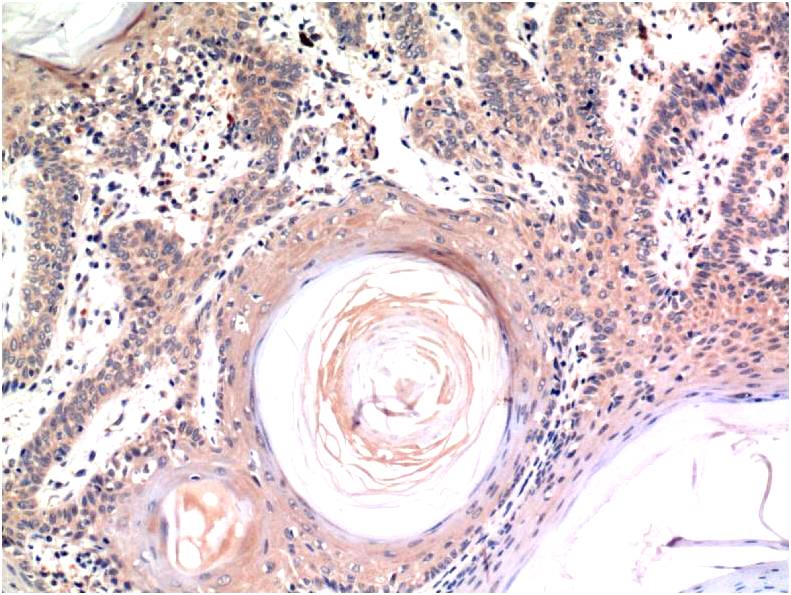 Immunohistochemical analysis of paraffin-embedded Human Skin Tissue using Caspase-3 (EM1266) Mouse mAb diluted at 1:200.