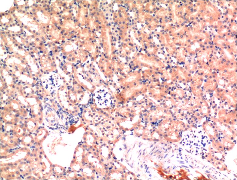 Immunohistochemical analysis of paraffin-embedded Mouse Kidney Tissue using Bax (EM1268) Mouse mAb diluted at 1:200.