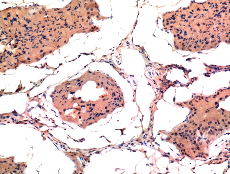 Immunohistochemical analysis of paraffin-embedded Rat Testis Tissue using Bax (EM1268) Mouse mAb diluted at 1:200.