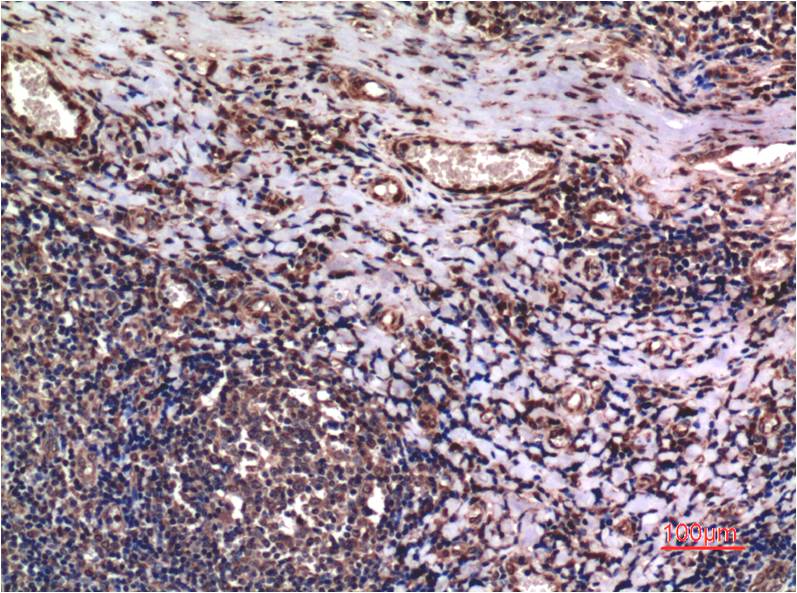Immunohistochemical analysis of paraffin-embedded Human Tonsil Tissue using Cyclin B1 ( EM1299 ) Mouse mAb diluted at 1:200.
